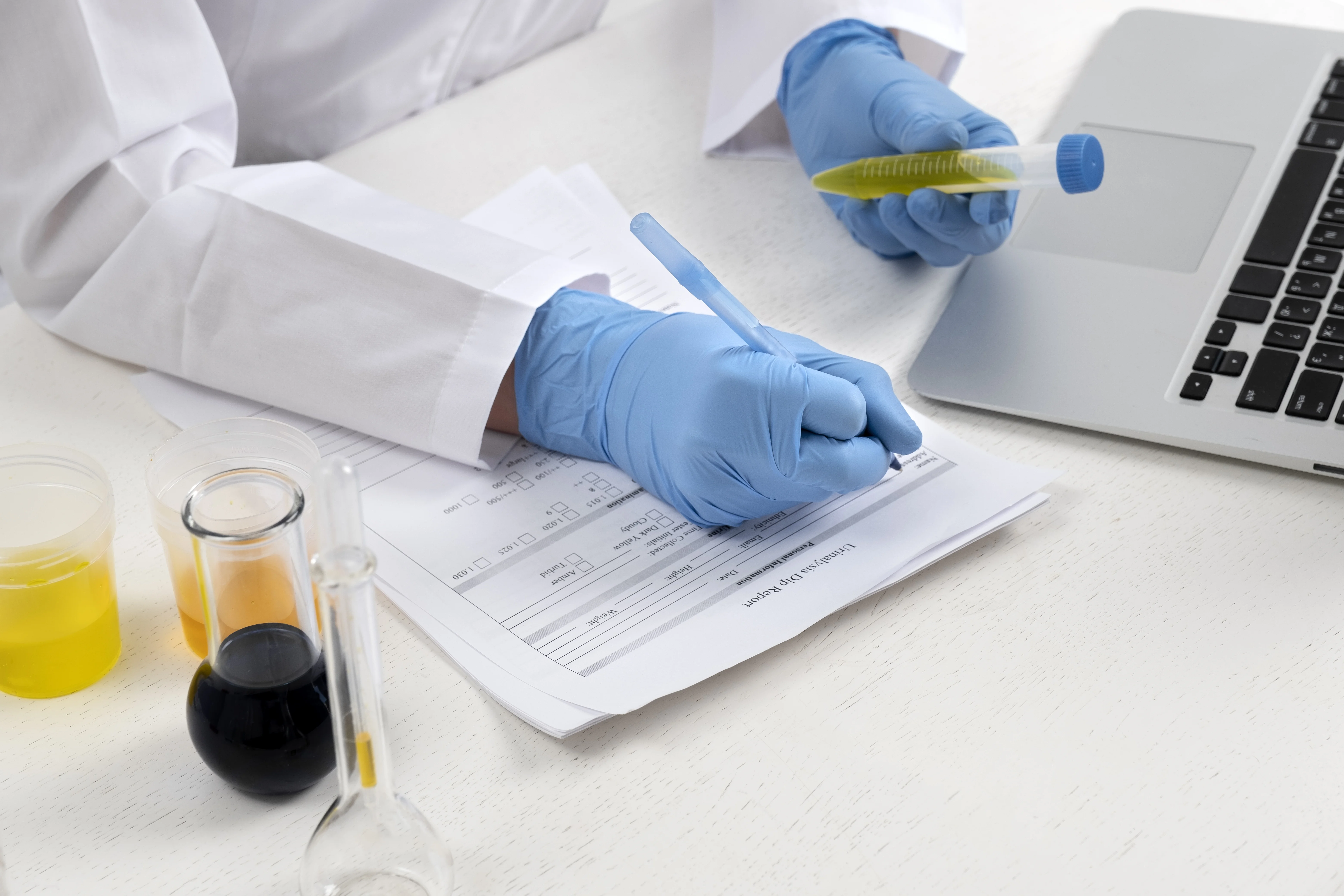 Online Drug Test: A Comprehensive Guide